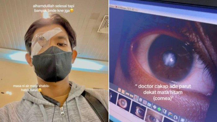 Muhammad Zabidi harus menjalani transplantasi kornea mata gara-gara kebiasaan mengucek mata.