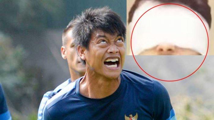 Mantan Kiper Arema Kurnia Meiga Kemungkinan Harus Transplantasi Mata
