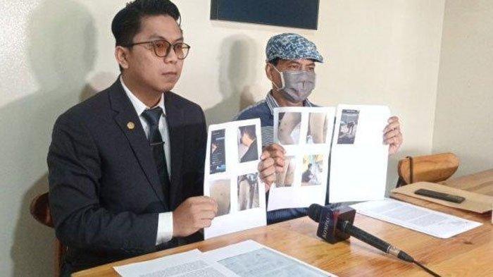 Pemuda dianiaya 30 orang hingga disekap selama tiga bulan karena tak bisa bayar utang Rp100 juta (via TribunJakarta.com)