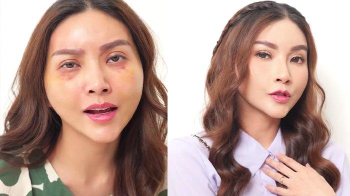Pengalaman Sarwendah Operasi Plastik di Korea Selatan, Jelaskan Proses dan Treatment yang Dilakukan