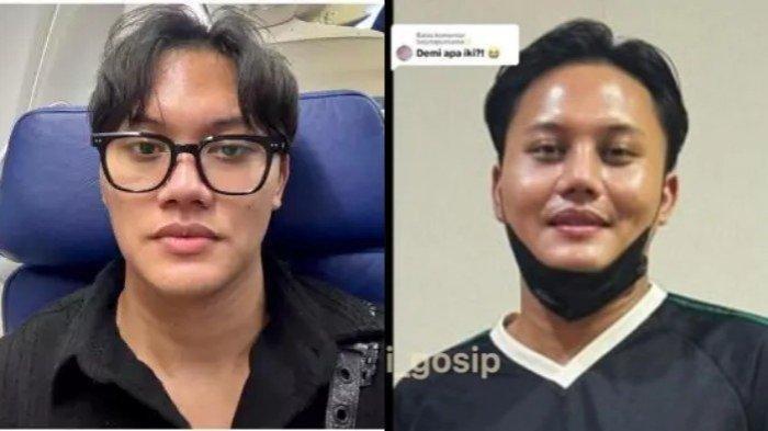 Potret perubahan wajah Rizky Febian sebelum (kiri) dan sesudah oplas hidung (kanan)