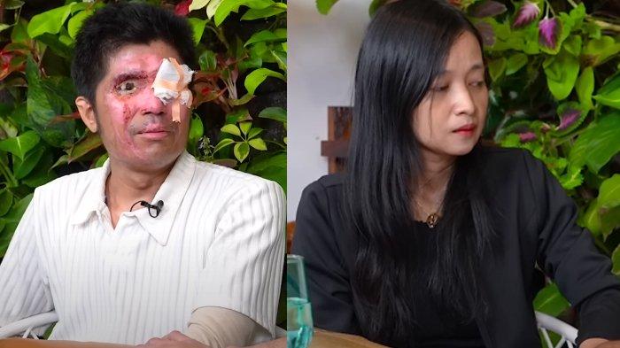 Tabiat Istri Agus Atasan Disiram Air Keras Diduga Tilap Uang Donasi Rp 500 Juta, Berobat Pakai BPJS