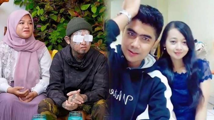 Tak Seperti Agus Salim, Ical Korban Congkel Mata di Bogor Tak Pakai Uang Donasi Sepeserpun