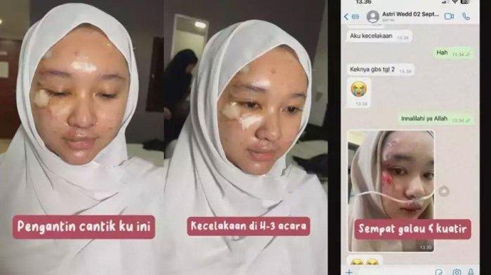 Tampang pengantin saat kecelakaan