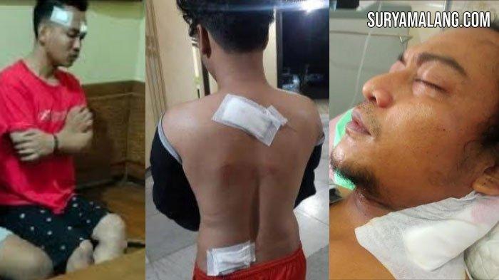 ULAH TUKANG PENCAK - Kiri, korban pembacopan bernama Danang Usdianto (24) asal Desa Sukobendu Kecamatan Mantup, Lamongan. Tengah, Muhammad Habib Irsad (20), mengalami luka bacok di punggung di jalan raya depan SDN I Gembong, Kecamatan Babat. Kanan, pengacara Ahmad Umar Buwang dibacok di Mantup.