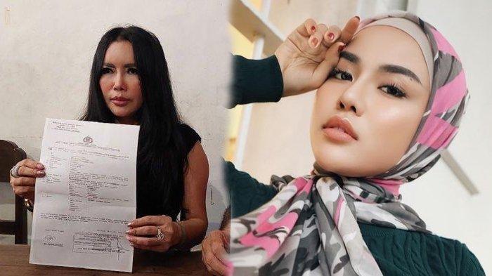 Uci Flowdea (pelapor) kasus penipuan tas hermes Medina Zein (kanan)