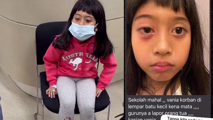 Vania Athabina adik Verrel Bramasta jadi korban bully di sekolah