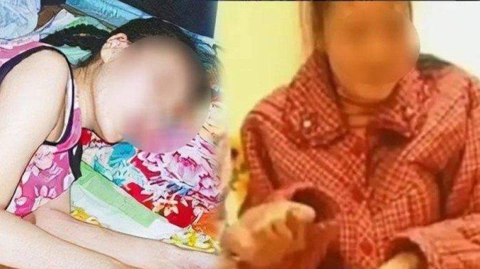 Viral Anak Gadis Pura-pura Lumpuh Agar Tak Disuruh Bantu Keluarga, Selama 20 Tahun Akting Sakit