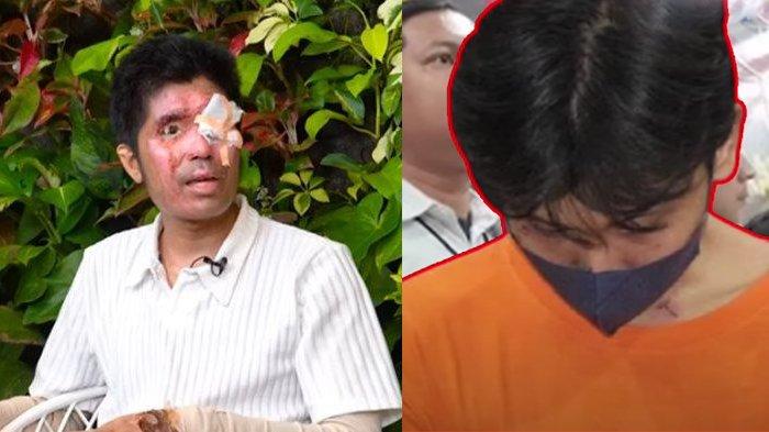 Wajah Asli Agus Sebelum Disiram Air Keras Karyawan Training, Menyesal Jadi Atasan Tak Jaga Lisan