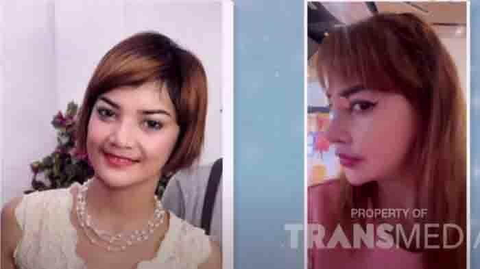 Wajah Irma Darmawangsa dulu (kiri) dan sekarang (kanan) setelah oplas