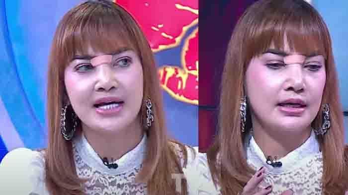 Wajah Irma Darmawangsa setelah oplas saat tampil di acara Rumpi