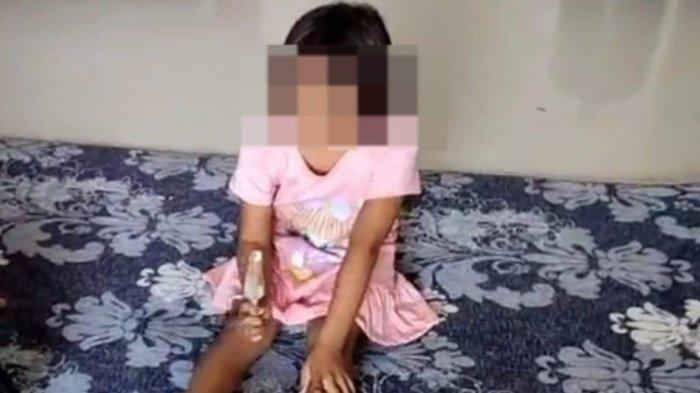 Seorang bocah kelas 2 SD di Gresik, Jawa Timur, mengalami buta permanen karena ditusuk oleh kakak kelas dengan tusukan bakso. Kini polisi menangani kasus tersebut.
