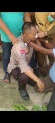 Seorang polisi dari Polsek Curug mengalami luka sobek akibat diserang ODGJ.