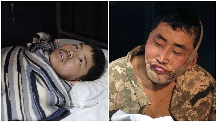Foto 2 pria Korea Utara yang diunggah oleh Presiden Ukraina Volodymyr Zelensky pada Minggu (12/1/2025). Keduanya adalah tentara Korea Utara yang ditugaskan di Kursk, Rusia, menurut cuplikan video interogasi yang dirilis oleh Zelensky.