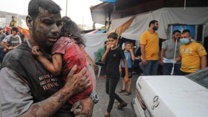 Seorang pria Palestina yang terluka dan seorang anak tiba di rumah sakit Al-Shifa di Kota Gaza setelah serangan Israel pada 29 Oktober 2023, di tengah pertempuran yang sedang berlangsung antara Israel dan gerakan Hamas Palestina.
