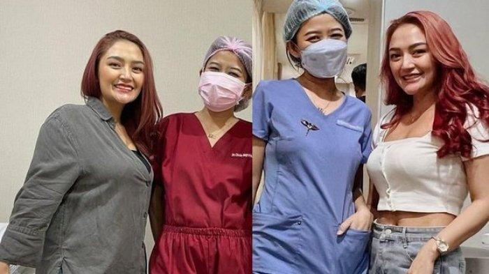 Siti Badriah menunjukkan seperti apa potret perbandingan saat ia baru pertama kali datang untuk konsultasi dan penampilan terbarunya kini.