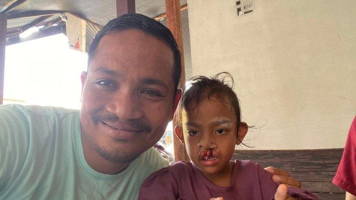 Koordinator Smile Train Aceh Rahmat Maulizar saat berfoto dengan Siti Mariyam salah satu pasien bibir sumbing asal Kabupaten Aceh Jaya, Sabtu (17/6/2023)