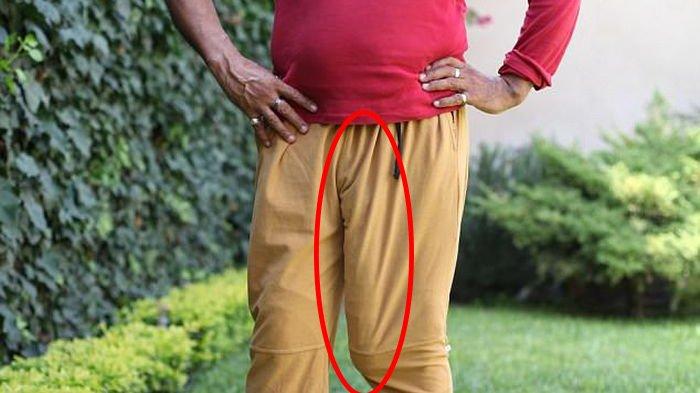 Miliki Panjang Organ Vital Hampir Setengah Meter, Pria Ini Justru Jadi