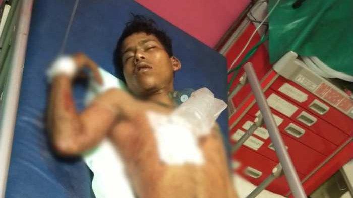 Dedianus Kaliyo (19) seorang pemuda asal Sumba Barat Daya, Nusa Tenggara Timur (NTT) yang dikeroyok oleh puluhan orang di Desa Bakbakan, Gianyar, Bali saat menjalani perawatan di rumah sakit, tubuhnya mengalami sejumlah luka-luka.
