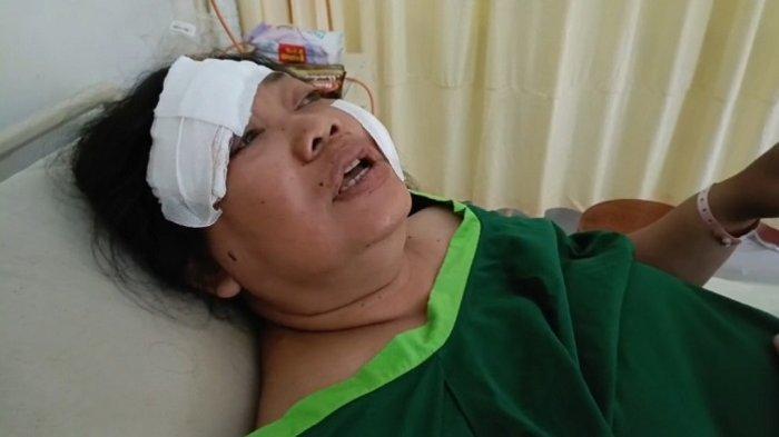 BEGAL - Pengemudi ojek online, Yuli Handayani (46) yang menjadi korban begal di Jalan Bukit Tengah, Desa Pesinggahan, Kecamatan Dawan, masih dirawat di RSUD Klungkung, Selasa (25/3/2025).