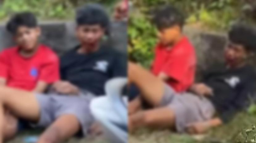 KETERLALUAN! Penabrak Tinggalkan Komang dan Ketut di Jalanan Buleleng dengan Kondisi Luka Parah