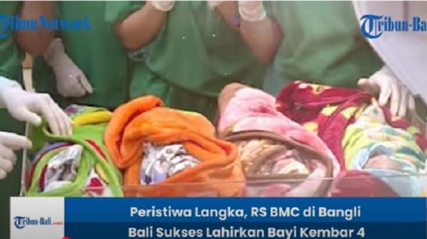 Kondisi 4 Bayi Perempuan Kembar di Bangli Bali, Ibu Belum Sempat Memeluk, Ungkap Rezeki Tuhan