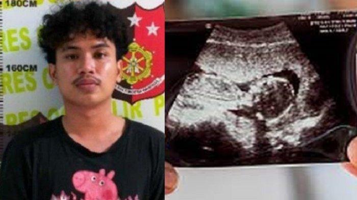 Sosok Diat Putra Nurkesuma, Paksa Mahasiswi UNSRI Minum Obat Penggugur Kandungan hingga Tewas