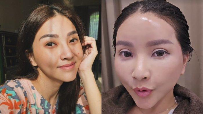 Sarwendah harus keramas di salon usai operasi plastik.