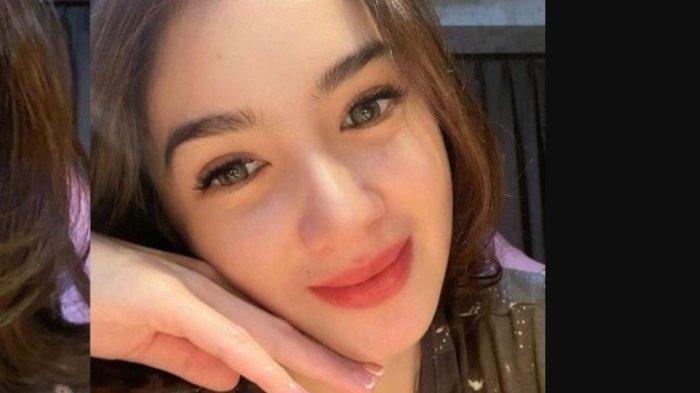 Angel Karamoy usai menjalani Oplas hidung di Korea.