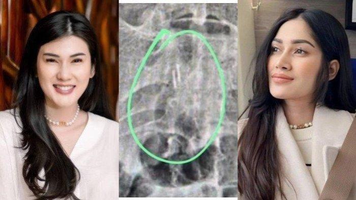 Sosok yang disebut-sebut menjadi penyebab santet Stevie Agnecya