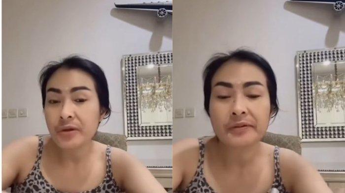 Iis Dahlia kala live tanpa make up.