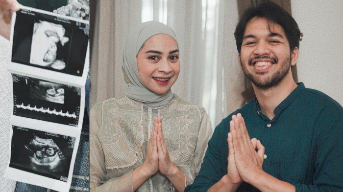 Kolase kabar kehamilan Ira Nandha istri Elmer Syaherman.