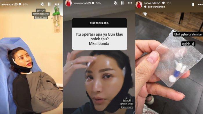Kolase penampakan Sarwendah pasca operasi plastik di Korea.