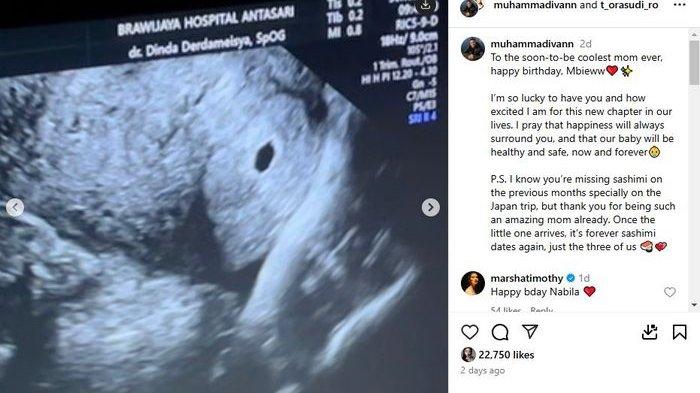 Menantu Tora Sudiro bocorkan kabar kehamilan sang istri.