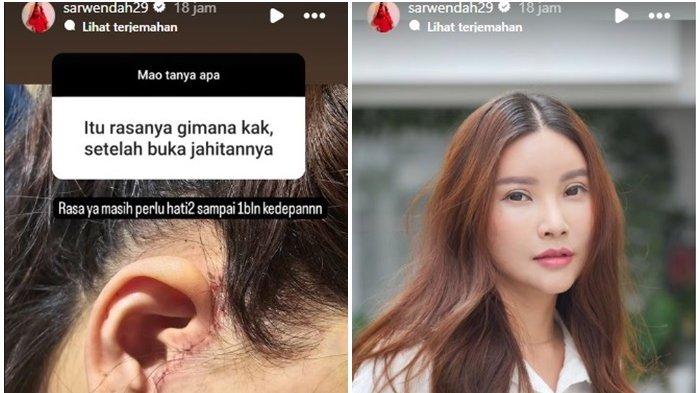 Sarwendah jawab pertanyaan netizen soal oplas.