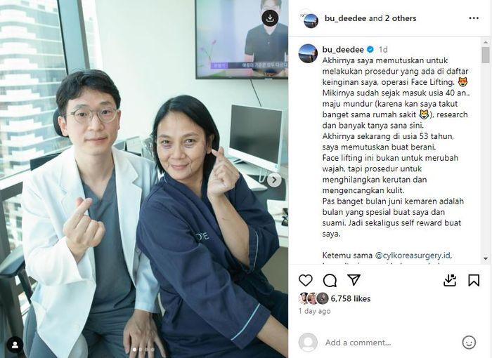 Dian Nitami menjalani oplas wajah.