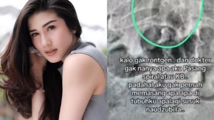 Stevie Agnecya sempat curiga dikirimi santet sebelum akhirnya meninggal dunia.