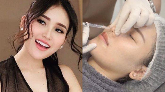 Ayu Ting Ting tanam benang