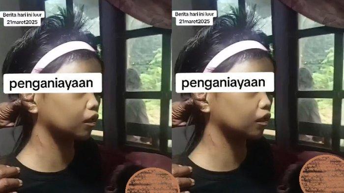 BABAK BELUR - Perempuan warga Desa Tanggeran, Kecamatan Somagede, Kabupaten Banyumas, Jawa Tengah, babak belur diduga dihajar majikan saat bekerja sebagai asisten rumah tanggi di sebuah keluarga di Pulogadung, Jakarta Timur. Kasus ini terungkap setelah diunggah akun Instagram @ahmadsahroni88. 