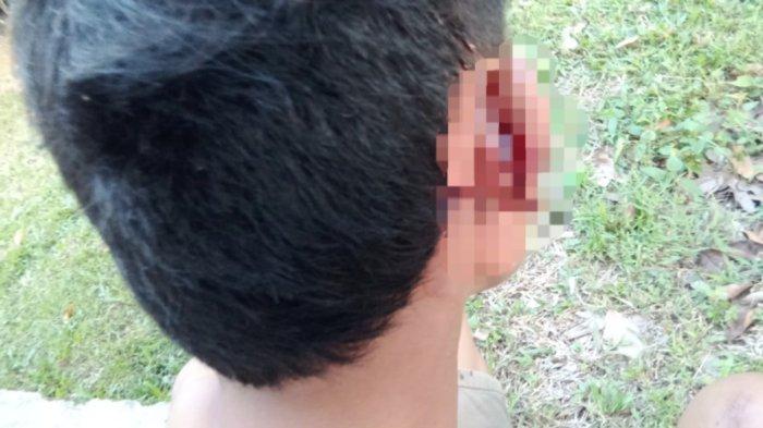 Abdullah tunjukan luka yang berada di telinga kanannya