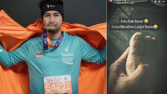 Kuku Kaki Raffi Ahmad hancur usai taklukkan New York Marathon 42 km. 