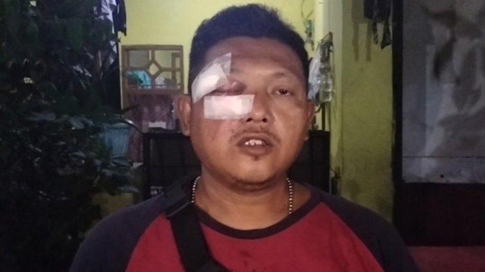 Rizal mengalami luka di bagian pelipis matanya saat menggagalkan aksi curanmor di Tanjung Priok, Jakarta Utara.