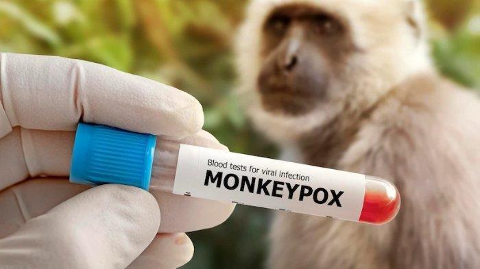 Ilustrasi Monkeypox atau cacar monyet.