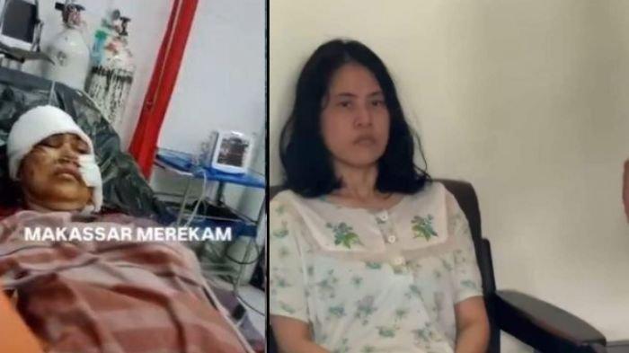 Kolase foto kondisi ibu korban (kiri) dan pelaku (kanan). 