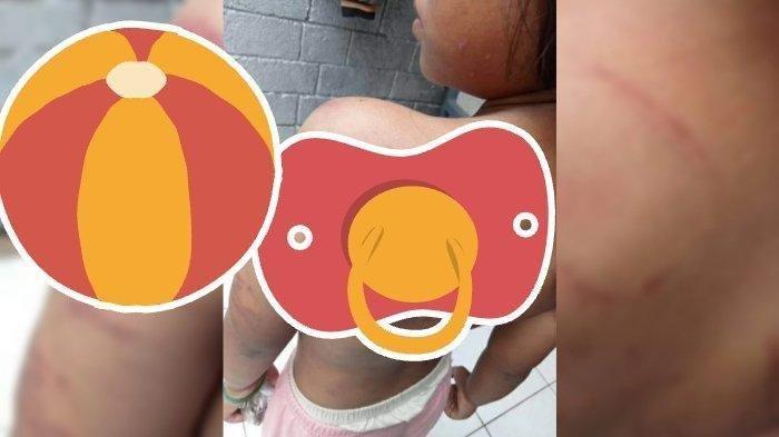 Tangkapan layar video beredar terkait bocah pengamen di Bogor yang viral di media sosial karena tubuhnya didapati luka-luka lebam diduga karena disiksa. (@infociseengid)