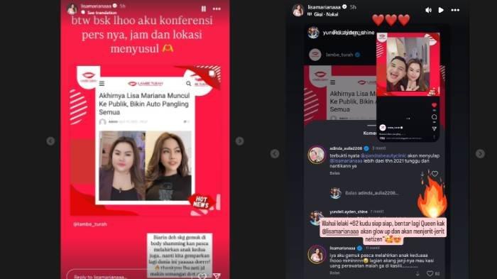 RESPON LISA DIBULLY NETIZEN - Lisa Mariana salahkan Ridwan Kamil dengan kondisi tubuhnya saat ini yang dibully netizen.
