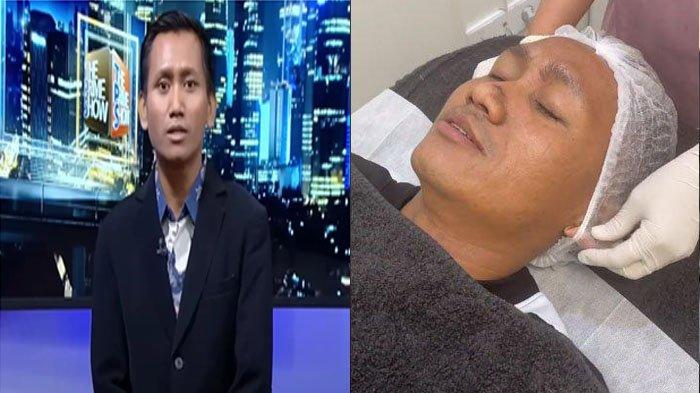 Nasib Mujur Pegi Setiawan usai Terlilit Kasus Vina, Kini Perawatan Wajah, Mau Jadi Direktur ?