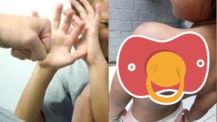 Seorang bocah berinisial N (7) di Bogor diduga disiksa oleh ayah kandungnya sendiri.