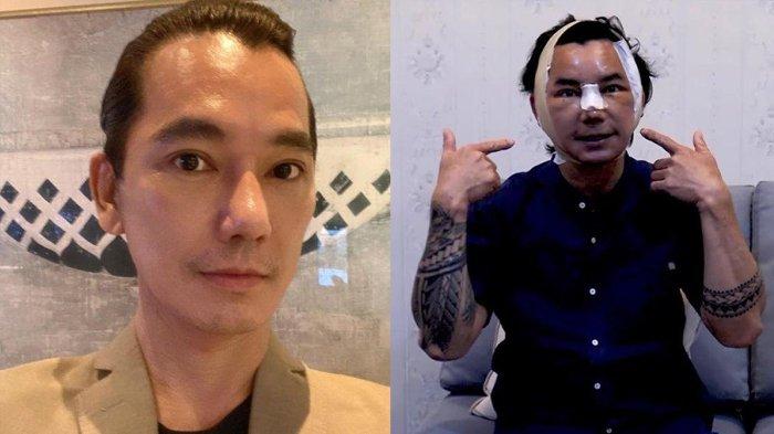 Eddy Siswanto dulu diusir dari galeri Masterchef karena berbuat curang, kini penampilannya bikin pangling usai melakukan operasi plastik