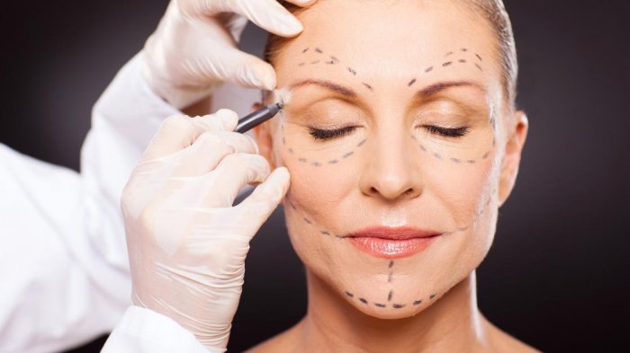 Ustaz Abdul Somad mengurai penjelasan soal hukumnya operasi plastik dan botox untuk perempuan. Ternyata ada yang diperbolehkan dan haram.